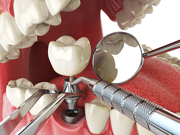 Trusted AR Emergency Dental Service Experts